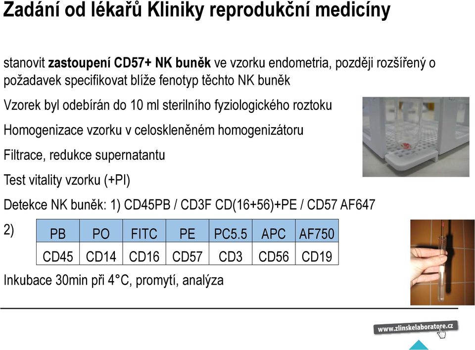 vzorku v celoskleněném homogenizátoru Filtrace, redukce supernatantu Test vitality vzorku (+PI) Detekce NK buněk: 1) CD45PB /