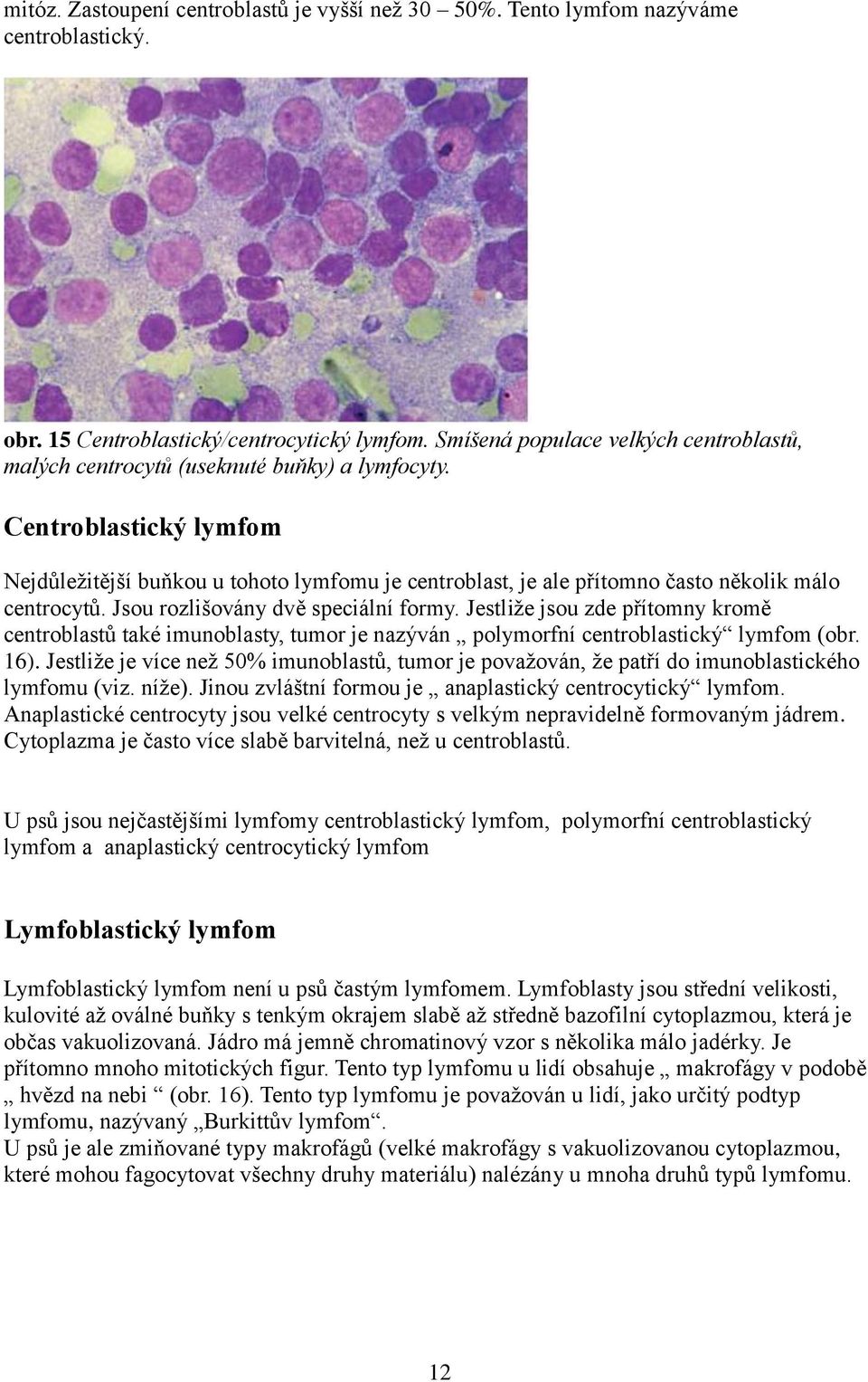 Centroblastický lymfom Nejdůležitější buňkou u tohoto lymfomu je centroblast, je ale přítomno často několik málo centrocytů. Jsou rozlišovány dvě speciální formy.