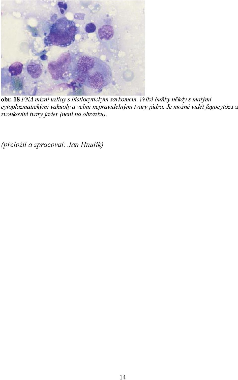 nepravidelnými tvary jádra.