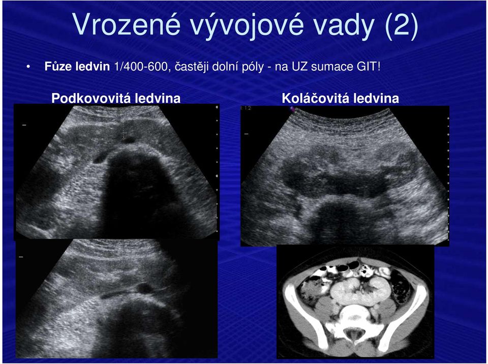 póly - na UZ sumace GIT!