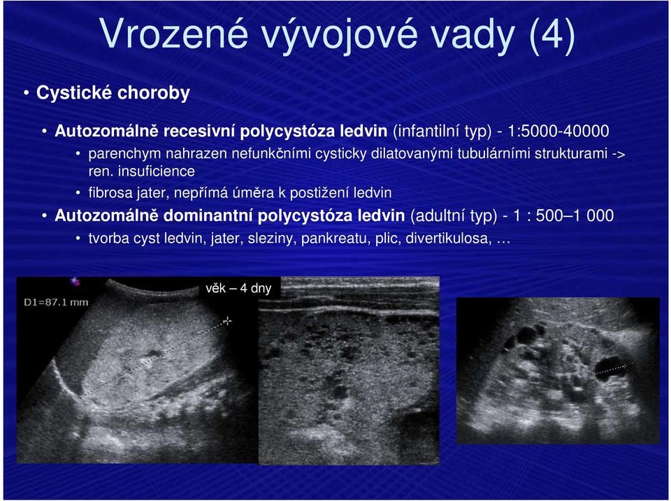 insuficience fibrosa jater, nepřímá úměra k postižení ledvin Autozomálně dominantní polycystóza ledvin