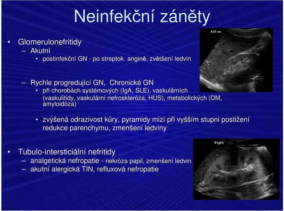 (vaskulitidy, vaskulární nefroskleróza, HUS), metabolických (DM, amyloidóza) zvýšená odrazivost kůry, pyramidy mizí při
