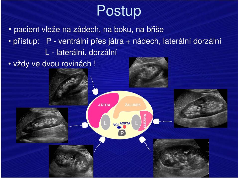 laterální dorzální L - laterální, dorzální vždy