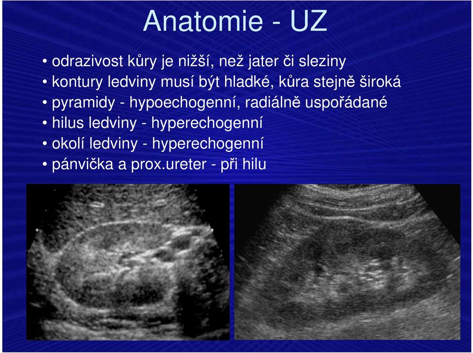 hypoechogenní, radiálně uspořádané hilus ledviny -