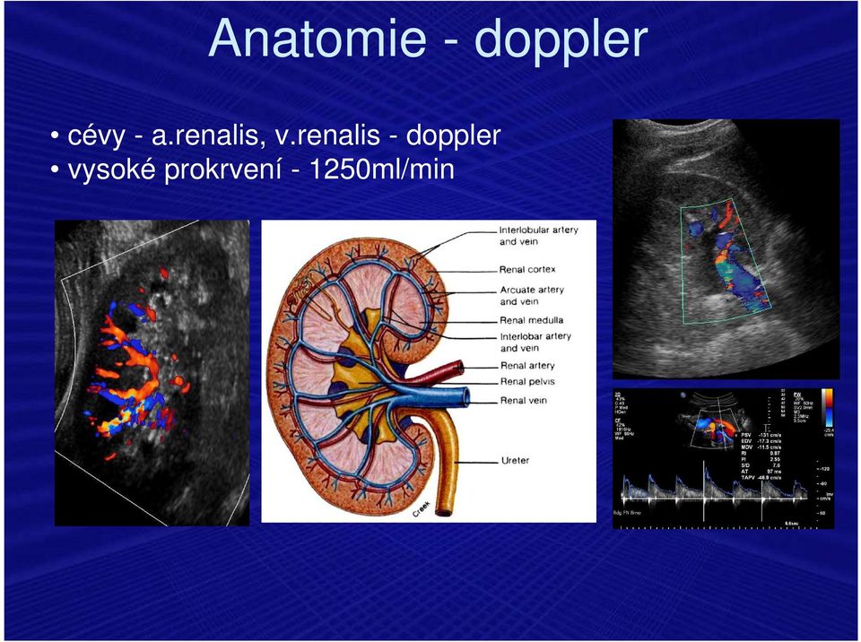 renalis - doppler