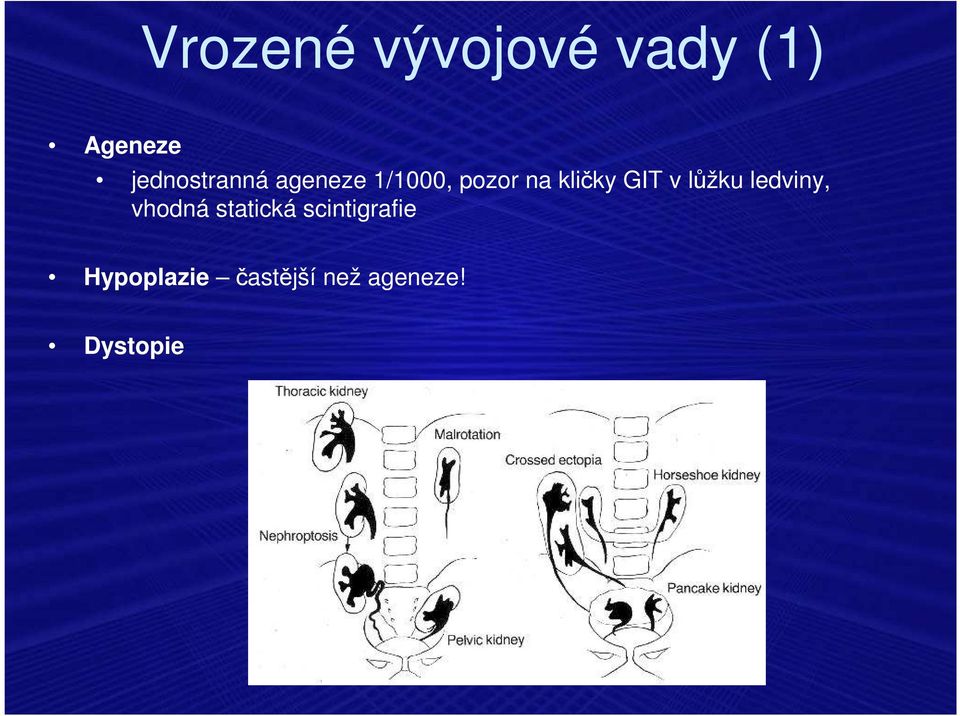 kličky GIT v lůžku ledviny, vhodná