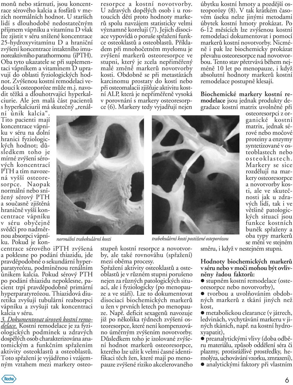 parathormonu (ipth). Oba tyto ukazatele se pøi suplementaci vápníkem a vitamínem D upravují do oblasti fyziologických hodnot. Zvýšenou kostní remodelaci vedoucí k osteoporóze mùže m.j. navodit tìžká a dlouhotrvající hyperkalciurie.