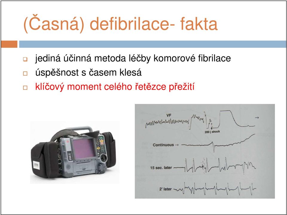 fibrilace úspěšnost s časem klesá