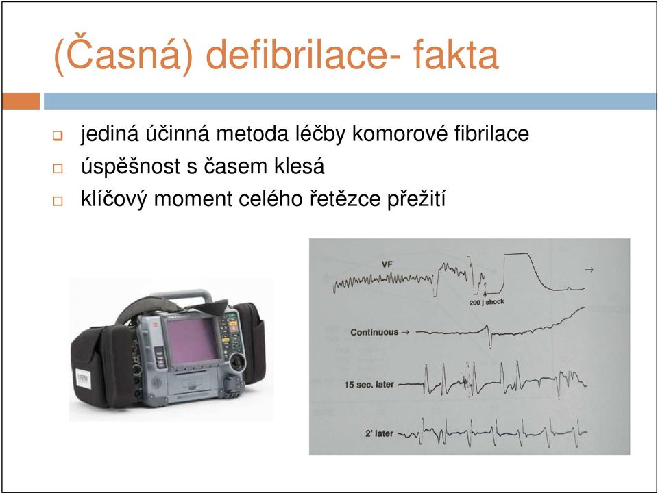 fibrilace úspěšnost s časem klesá