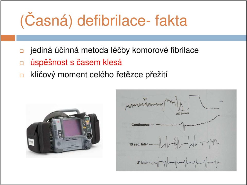 fibrilace úspěšnost s časem klesá