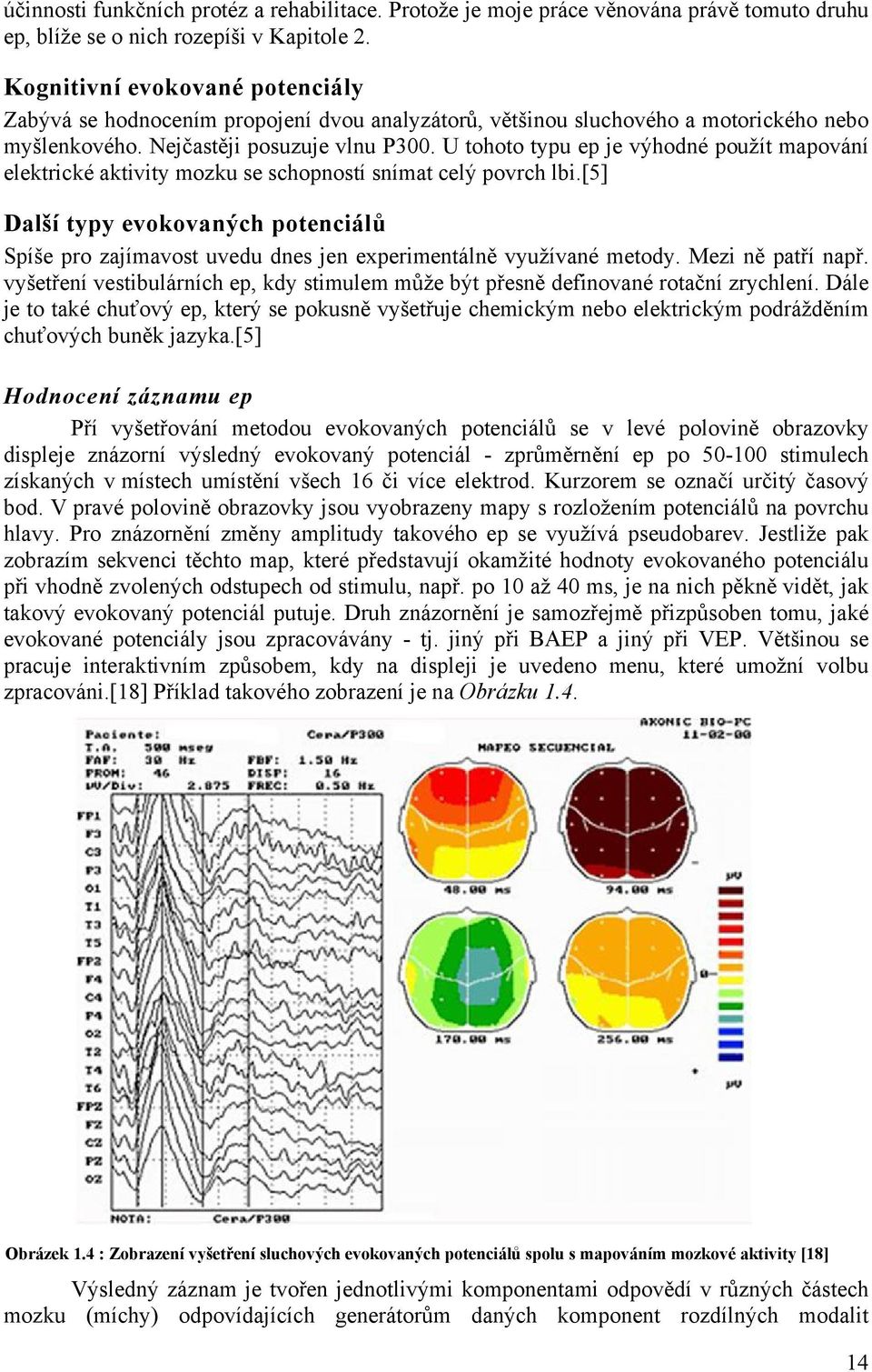 U tohoto typu ep je výhodné použít mapování elektrické aktivity mozku se schopností snímat celý povrch lbi.