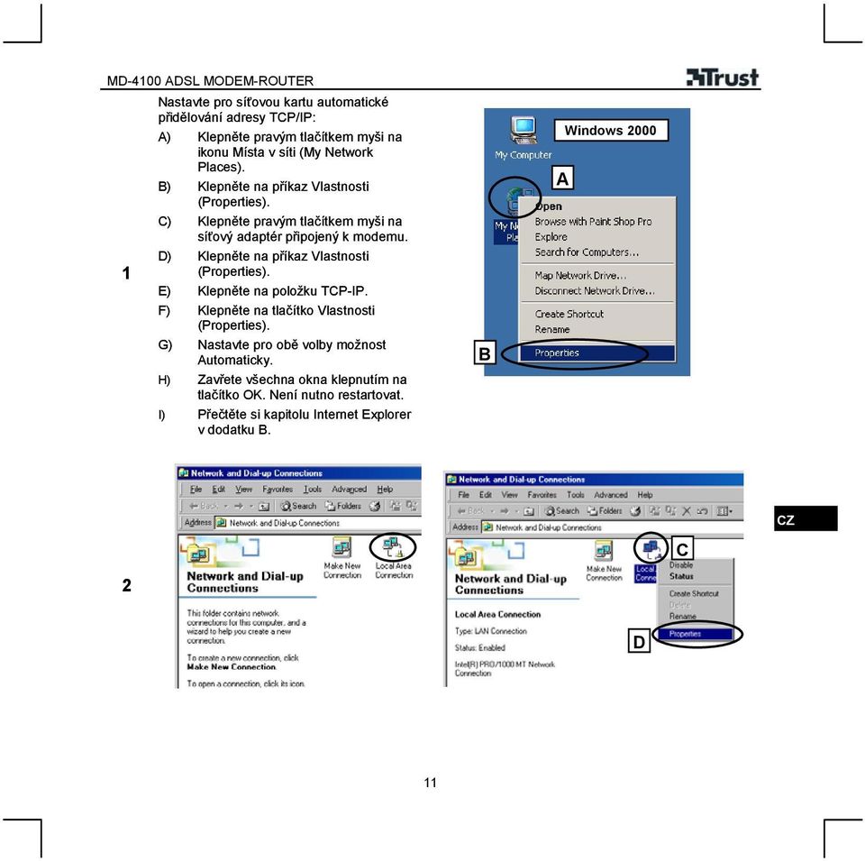 D) Klepněte na příkaz Vlastnosti (Properties). E) Klepněte na položku TCP-IP. F) Klepněte na tlačítko Vlastnosti (Properties).