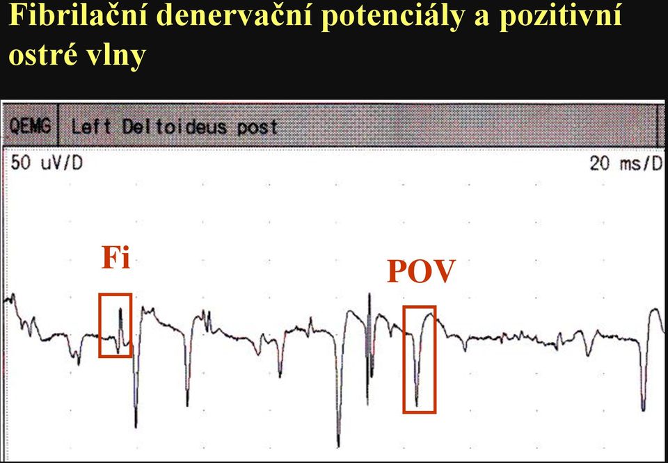 potenciály a