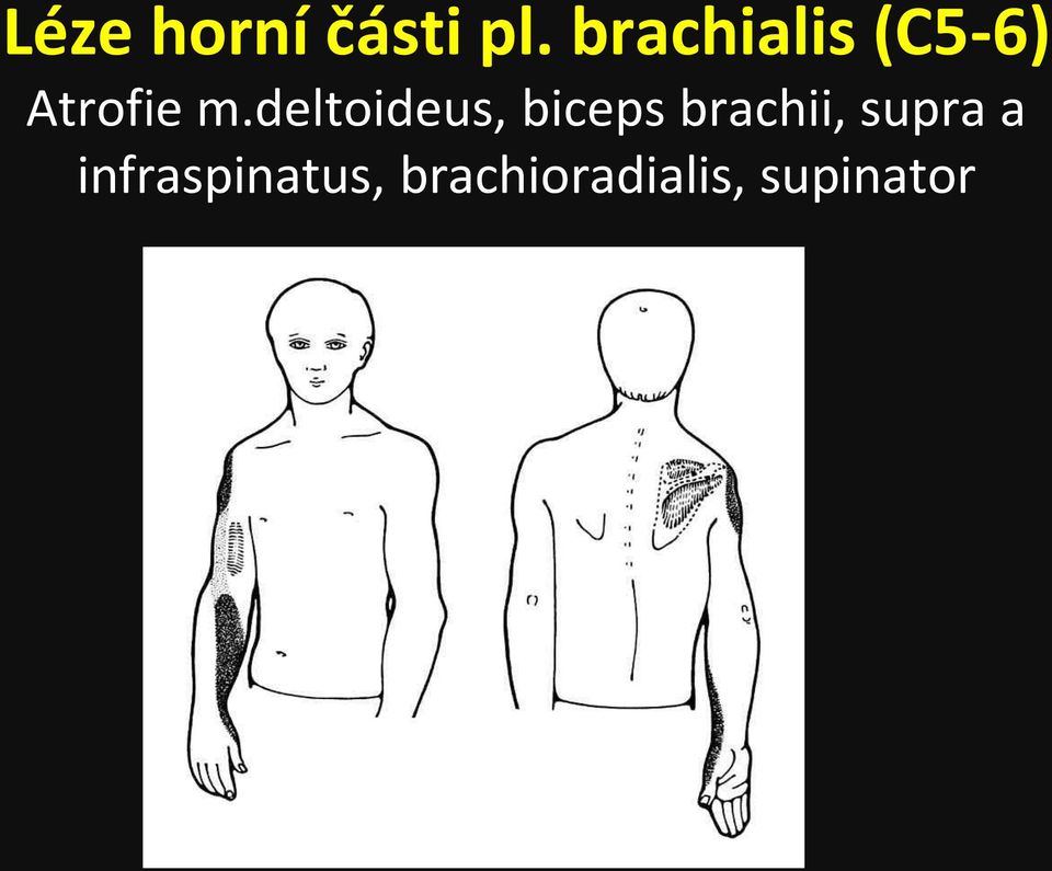 deltoideus, biceps brachii,
