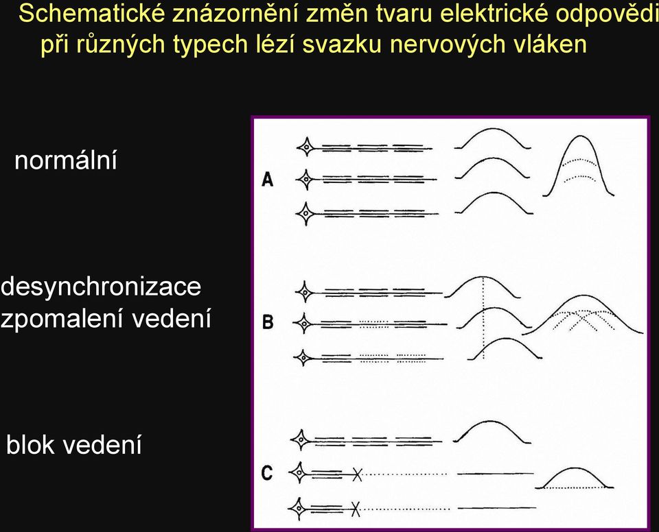 lézí svazku nervových vláken normální