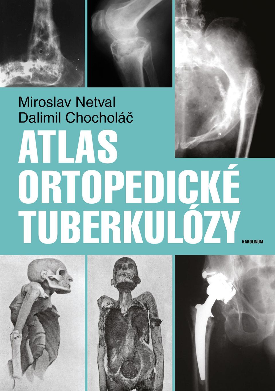 ATLAS ORTOPEDICKÉ