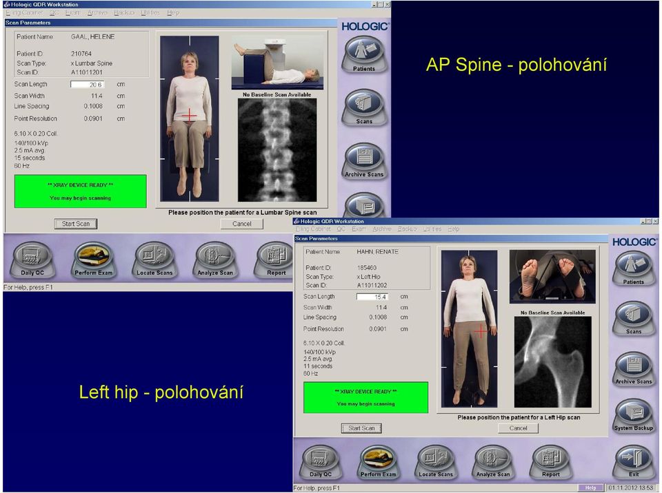 AP Spine -