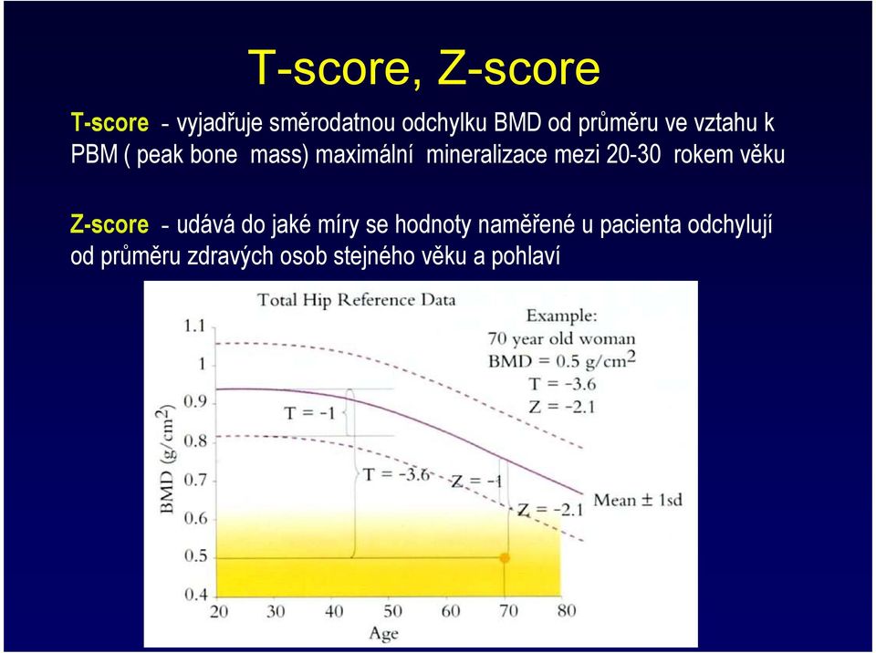 mezi 20-30 rokem věku Z-score - udává do jaké míry se hodnoty