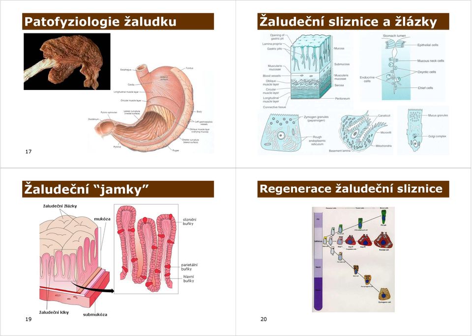 žlázky 17 18 Žaludeční