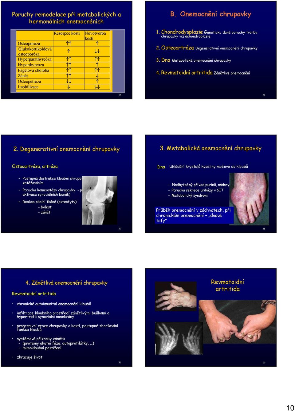 Dna Metabolické onemocnění chrupavky 4. Revmatoidní artritida Zánětlivé onemocnění 55 56 2. Degenerativní onemocnění chrupavky 3.