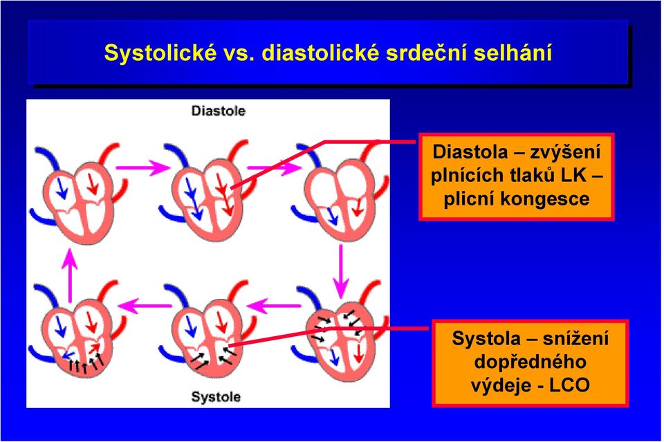 Diastola zvýšení plnících tlaků