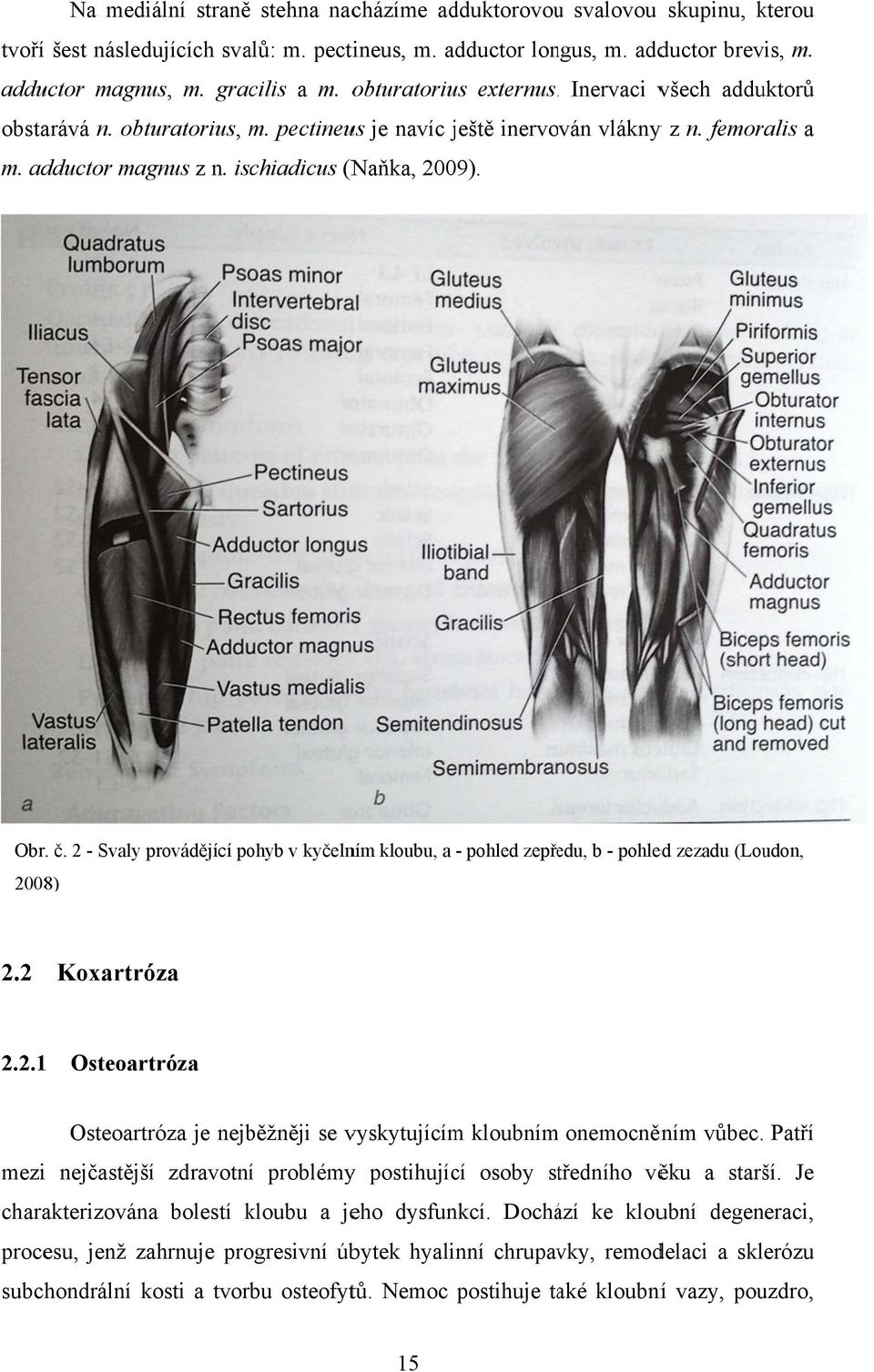 2 - Svaly provádějící pohyb v kyčelním kloubu, a - pohled zepředu, b - pohled zezadu (Loudon, 2008) 2.2 Koxartróza 2.2.1 Osteoartróza Osteoartróza je nejběžněji se vyskytujícím kloubnímm onemocněním vůbec.