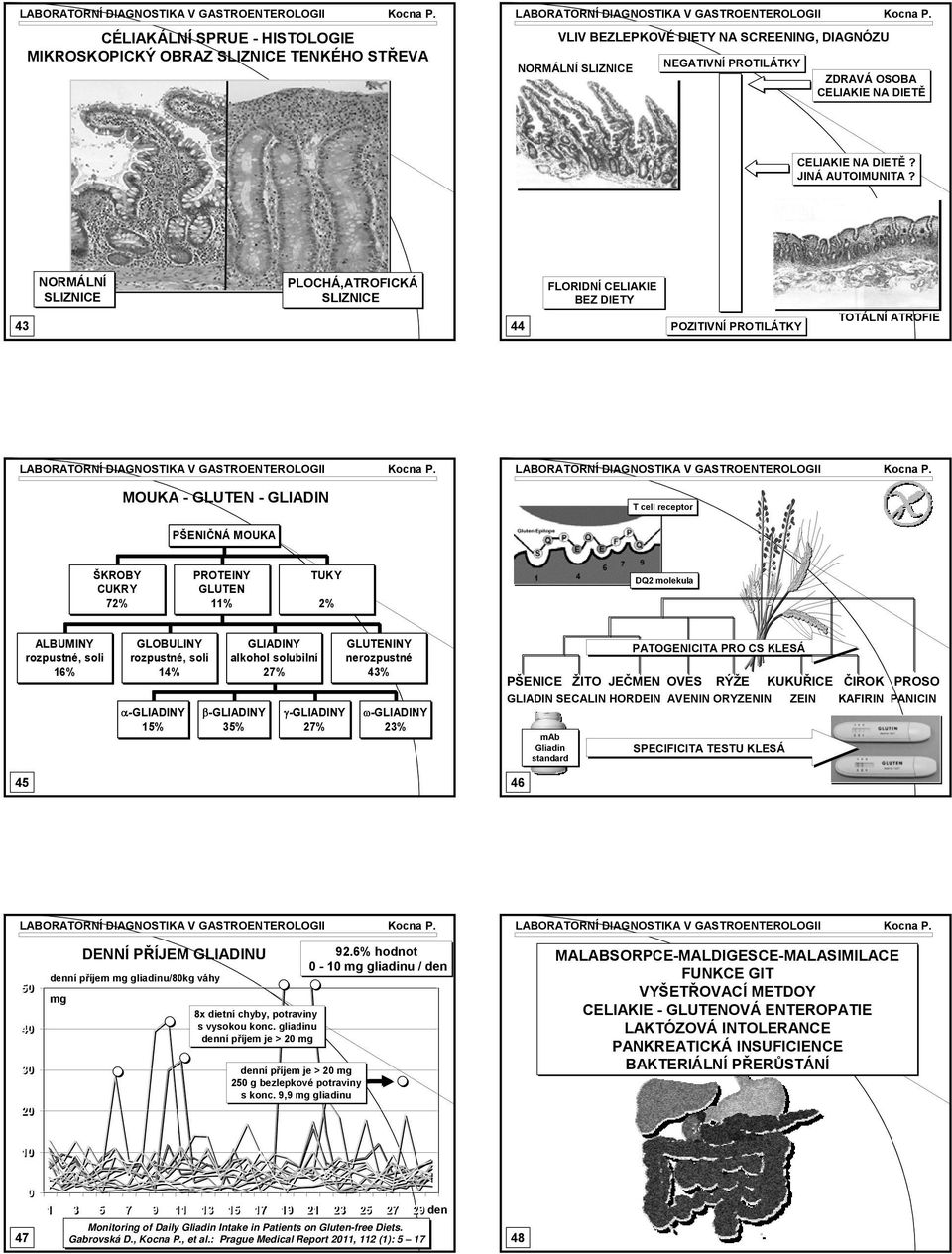 43 NORMÁLNÍ SLIZNICE PLOCÁ,ATROFICKÁ SLIZNICE 44 FLORIDNÍ CELIAKIE BEZ DIETY POZITIVNÍ PROTILÁTKY TOTÁLNÍ ATROFIE MOUKA - GLUTEN - GLIADIN T cell receptor PŠENIČNÁ MOUKA ŠKROBY CUKRY 72% PROTEINY