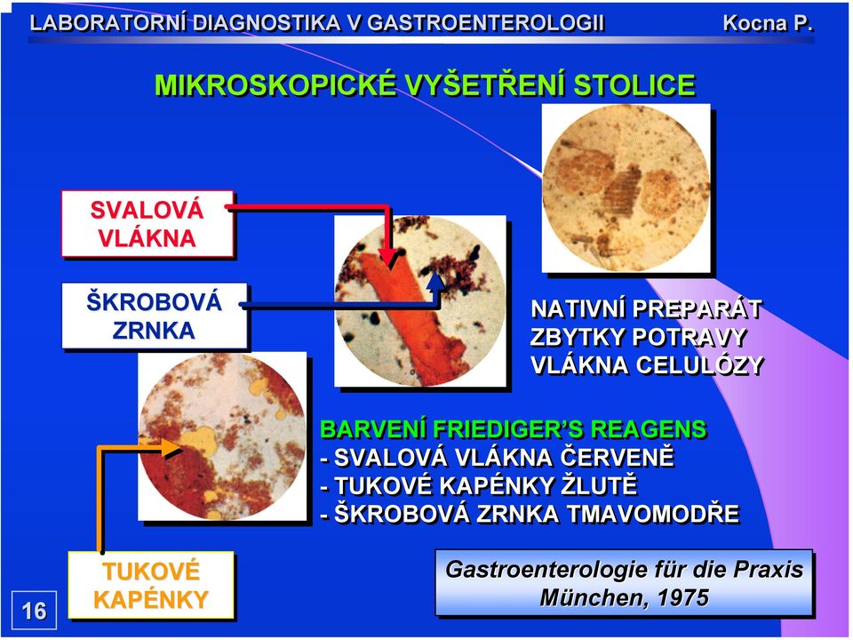 FRIEDIGER S REAGENS - SVALOVÁ VLÁKNA ČERVENĚ - TUKOVÉ KAPÉNKY ŽLUTĚ -