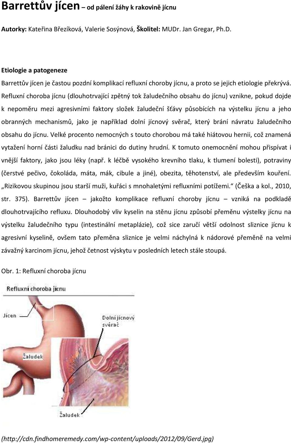 Refluxní choroba jícnu (dlouhotrvající zpětný tok žaludečního obsahu do jícnu) vznikne, pokud dojde k nepoměru mezi agresivními faktory složek žaludeční šťávy působících na výstelku jícnu a jeho