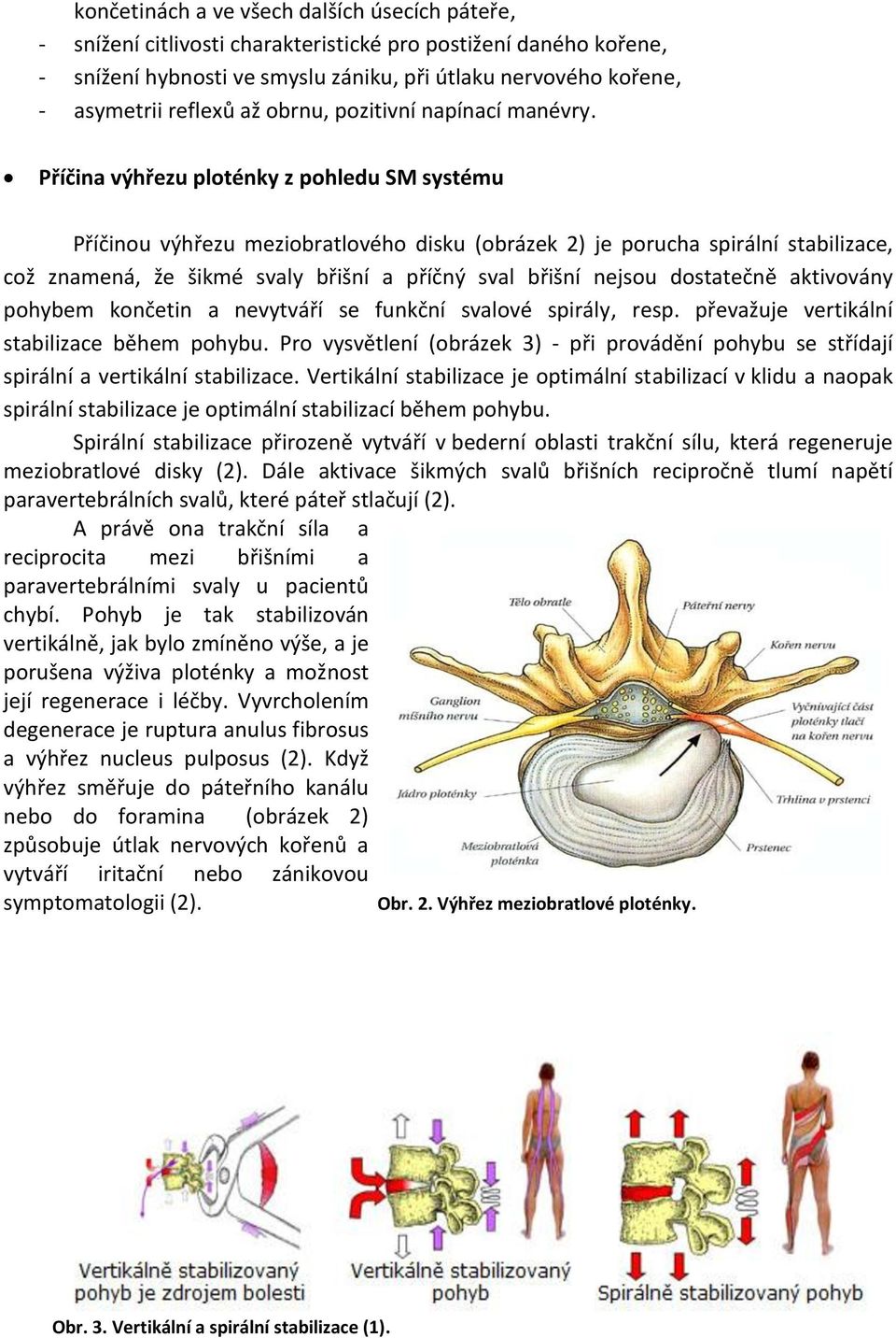 Příčina výhřezu ploténky z pohledu SM systému Příčinou výhřezu meziobratlového disku (obrázek 2) je porucha spirální stabilizace, což znamená, že šikmé svaly břišní a příčný sval břišní nejsou