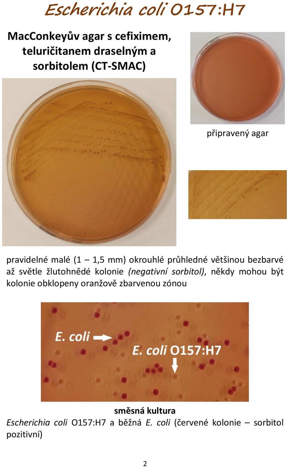 žlutohnědé kolonie (negativní sorbitol), někdy mohou být kolonie obklopeny oranžově