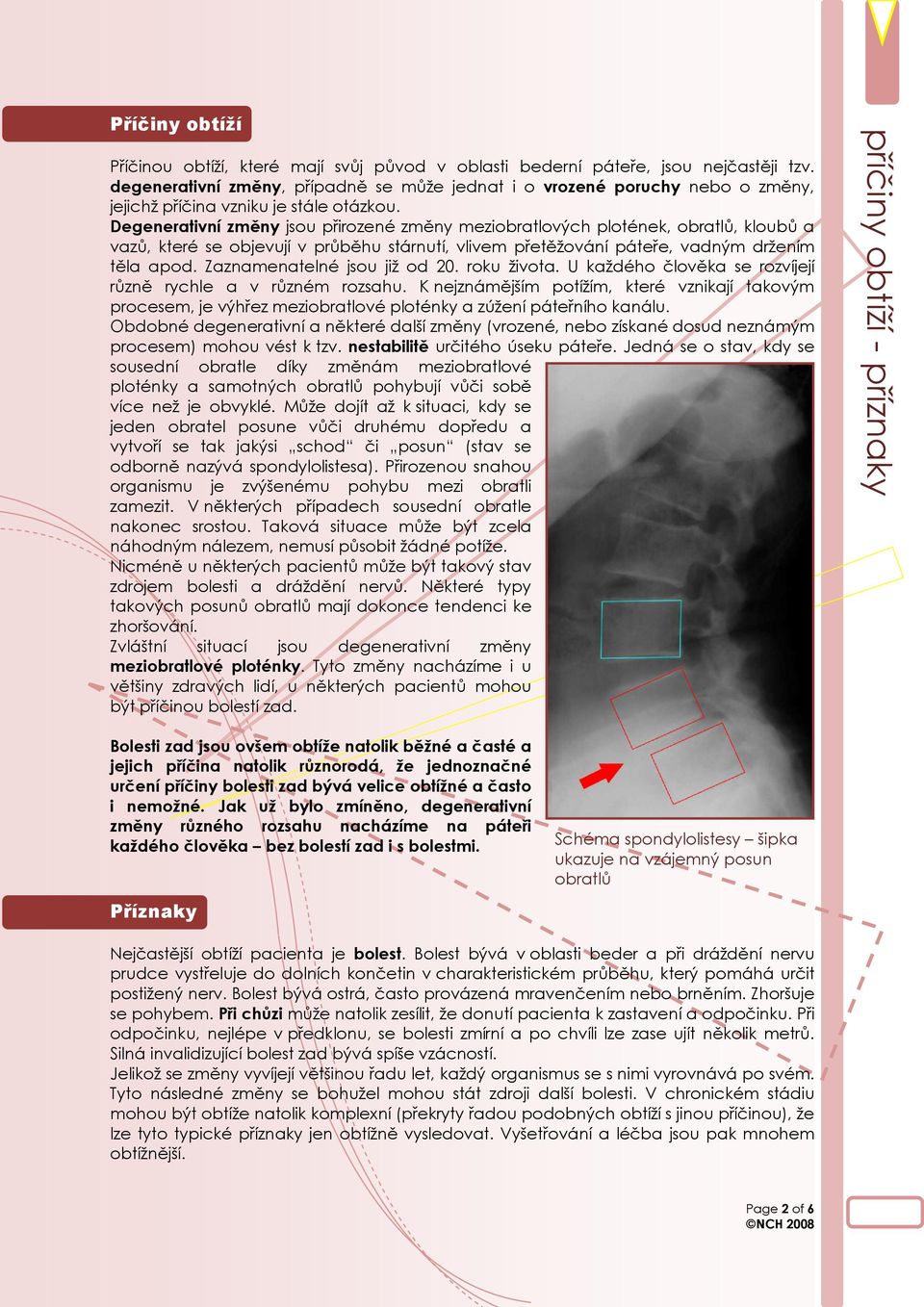 Degenerativní změny jsou přirozené změny meziobratlových plotének, obratlů, kloubů a vazů, které se objevují v průběhu stárnutí, vlivem přetěžování páteře, vadným držením těla apod.