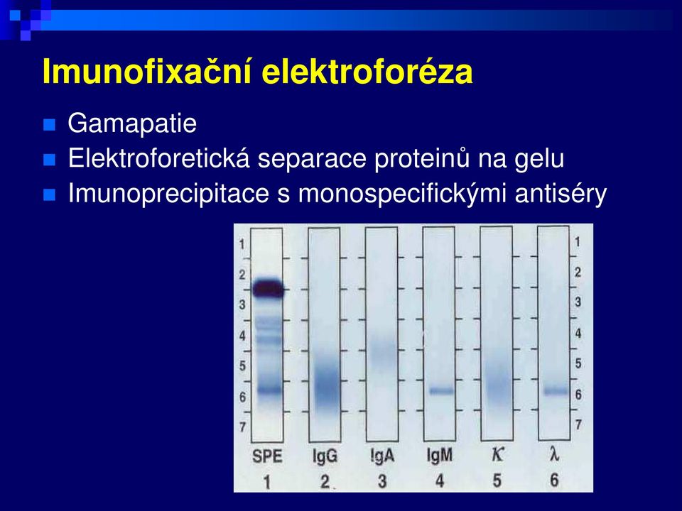 separace proteinů na gelu