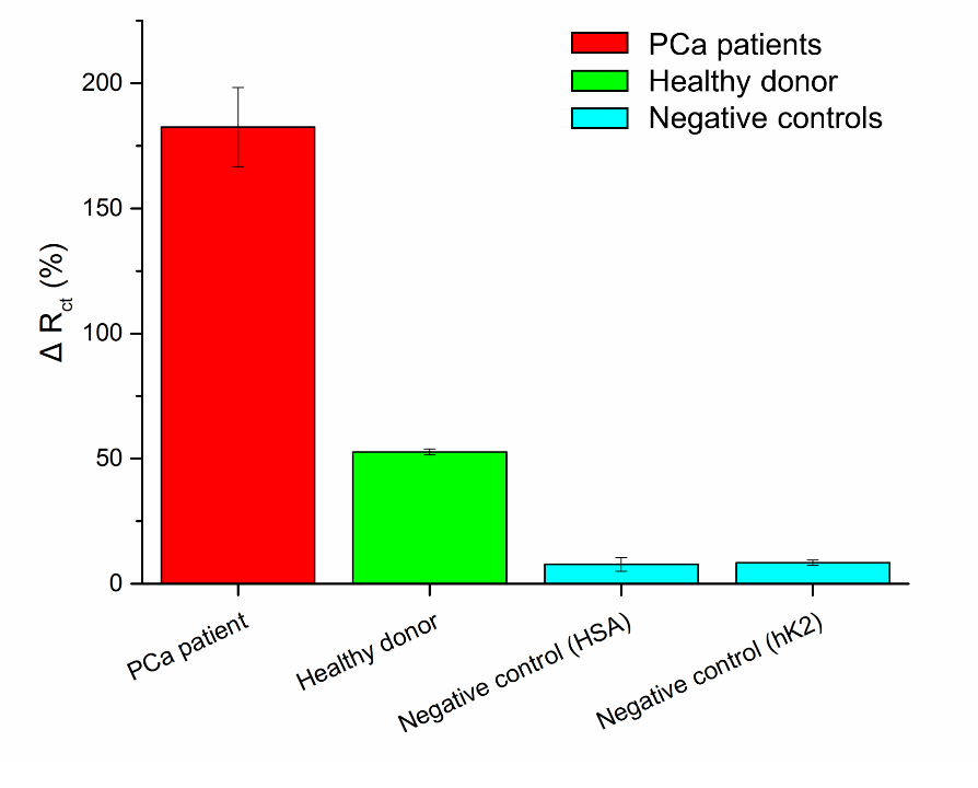 R ct after lecitn [%] Glykoprofilace reálných vzorků od pacientů 65 55 45 35 25 15 5 Lektinový imunosensor v analýze lidských sér (depletovaných od IgG a HSA) pomocí elektrochemické impedanční