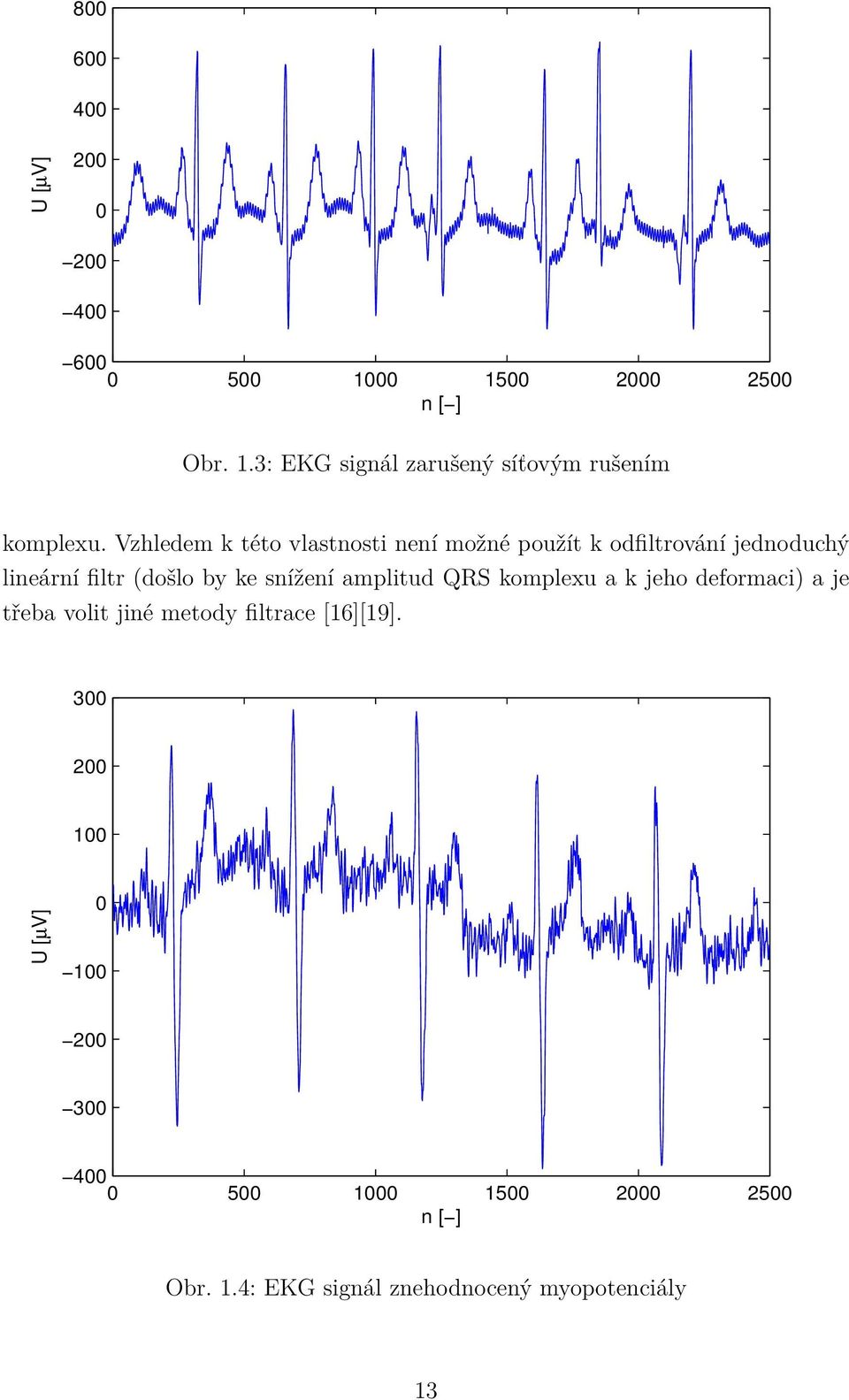 ke snížení amplitud QRS komplexu a k jeho deformaci) a je třeba volit jiné metody filtrace