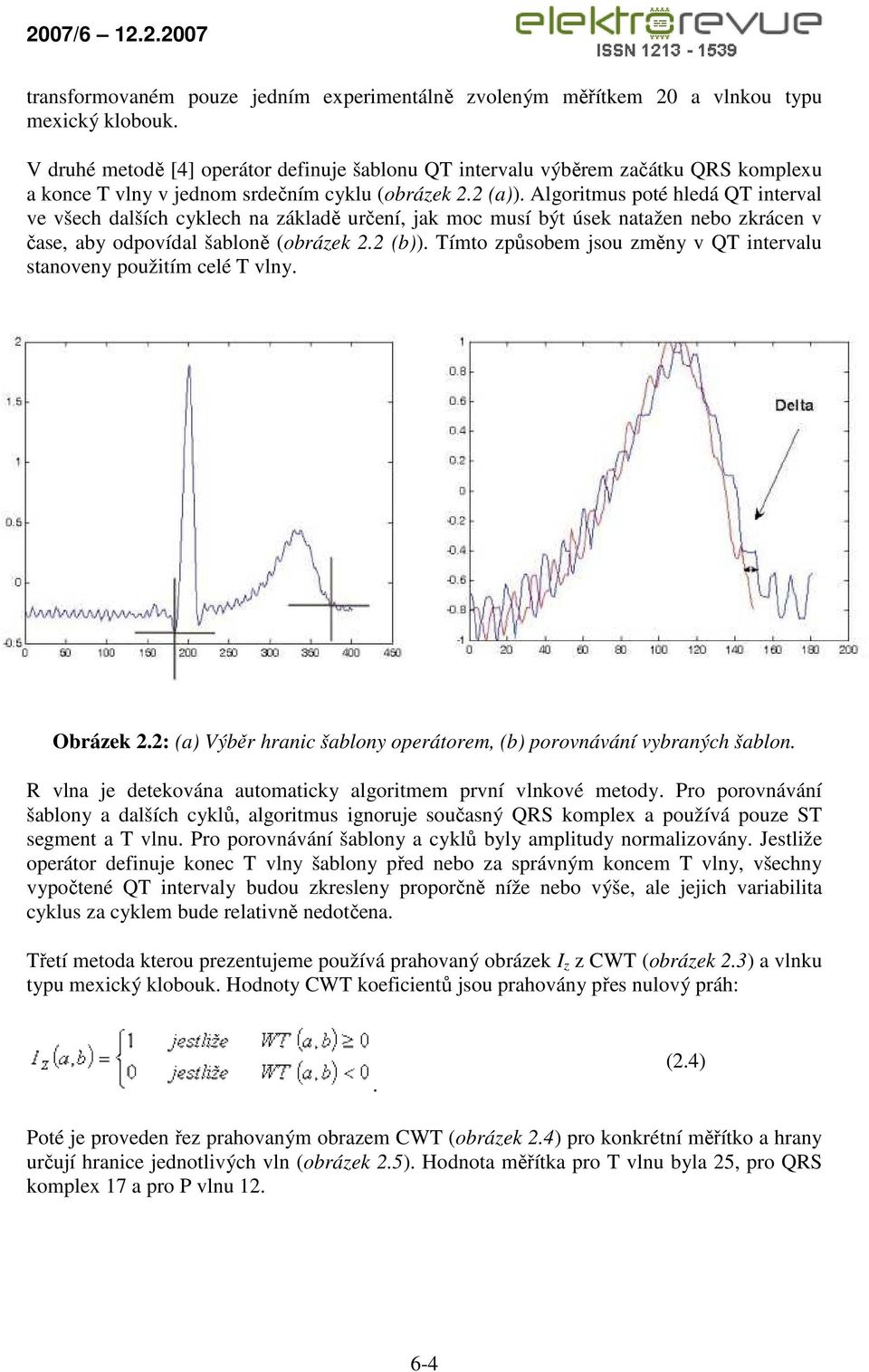 Algoritmus poté hledá QT interval ve všech dalších cyklech na základě určení, jak moc musí být úsek natažen nebo zkrácen v čase, aby odpovídal šabloně (obrázek 2.2 (b)).