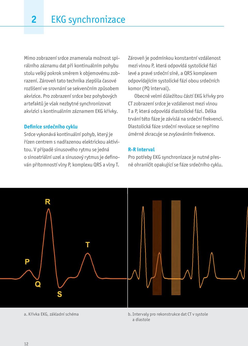 Pro zobrazení srdce bez pohybových artefaktů je však nezbytné synchronizovat akvizici s kontinuálním záznamem EKG křivky.
