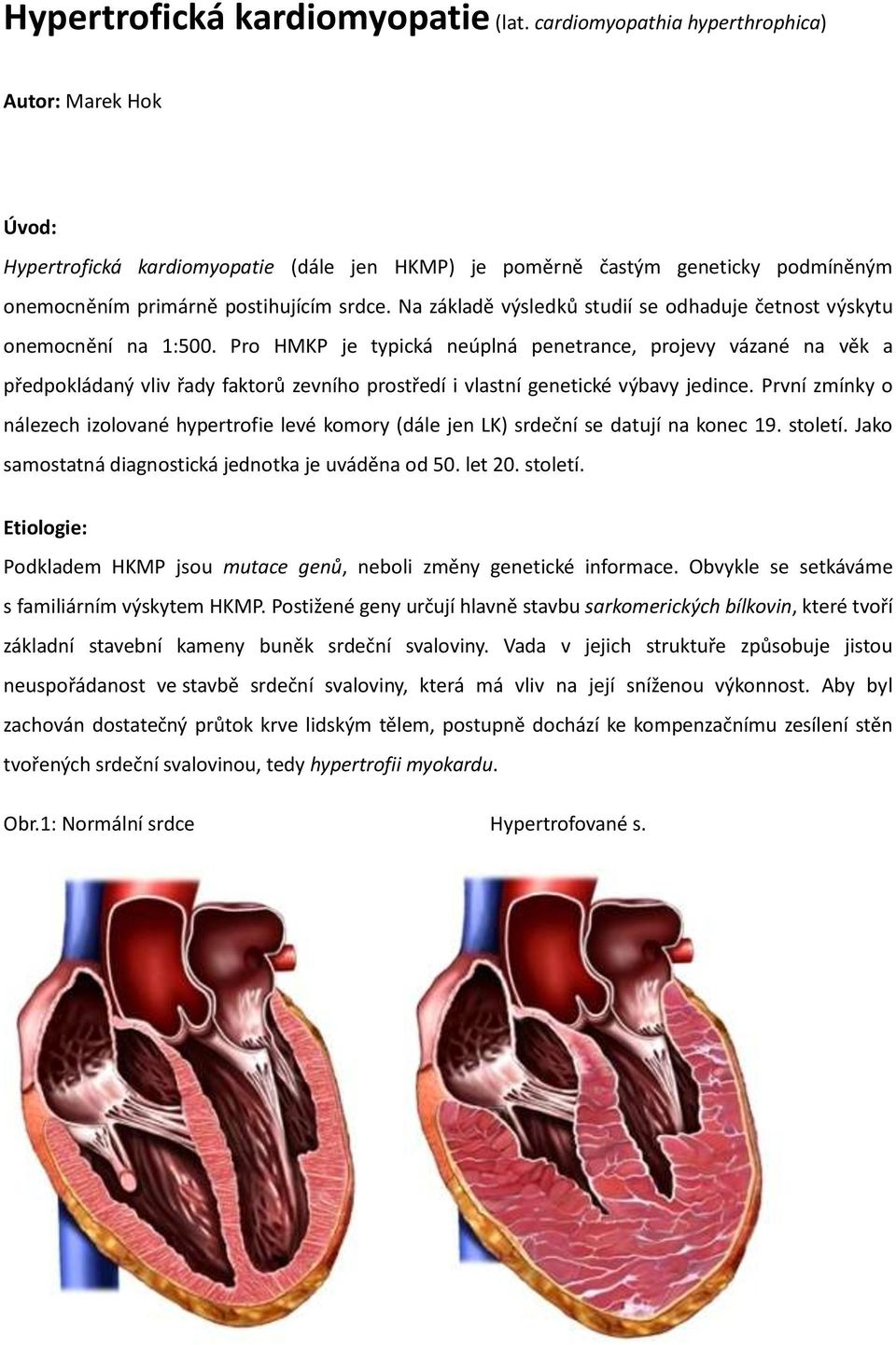 Na základě výsledků studií se odhaduje četnost výskytu onemocnění na 1:500.