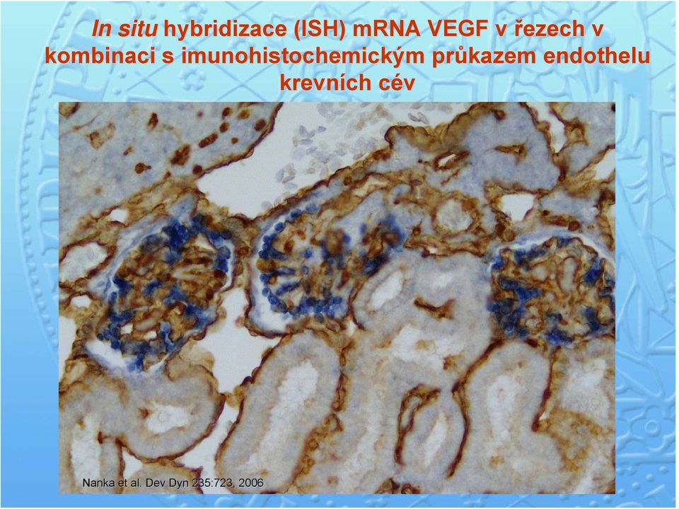 imunohistochemickým průkazem