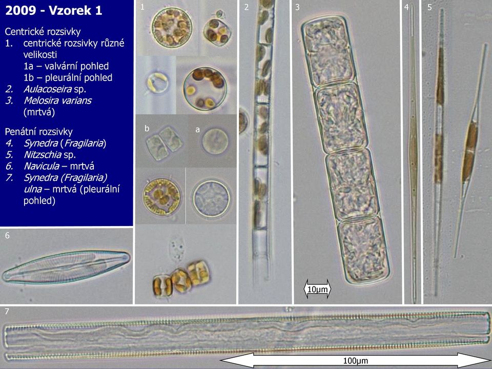 Aulacoseira sp. 3. Melosira varians (mrtvá) Penátní rozsivky 4.