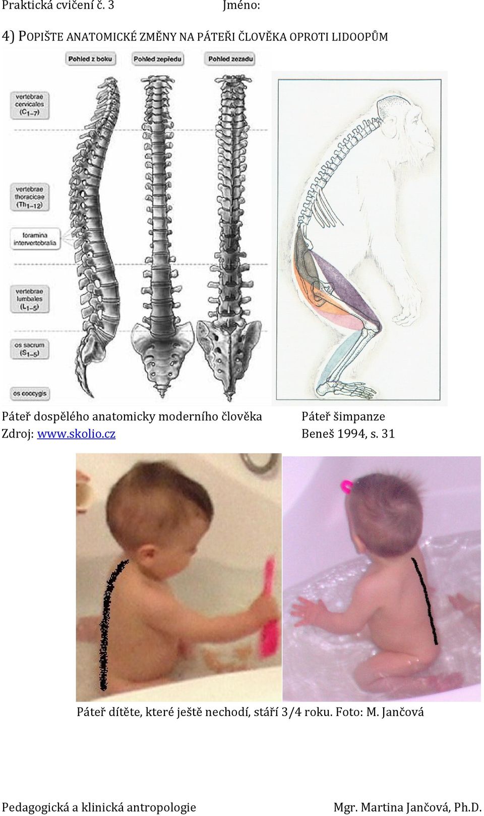 Páteř šimpanze Zdroj: www.skolio.cz Beneš 1994, s.