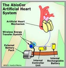 Obr. 3.28 Umělé srdce Abiocor [45] Obr. 3.29 Schéma zapojení k pacientovi [45] Obr.