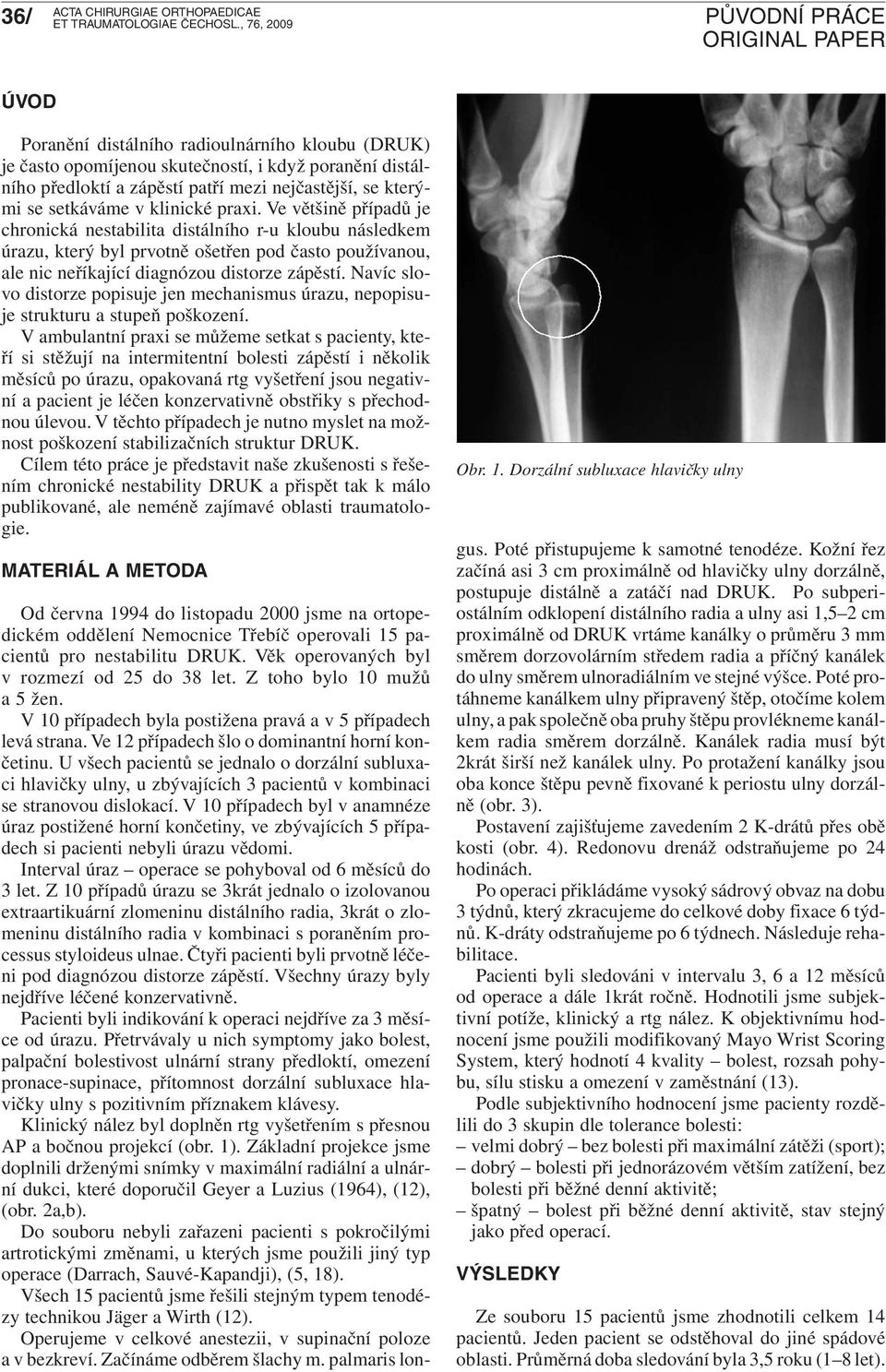 Navíc slovo distorze popisuje jen mechanismus úrazu, nepopisuje strukturu a stupeň poškození.