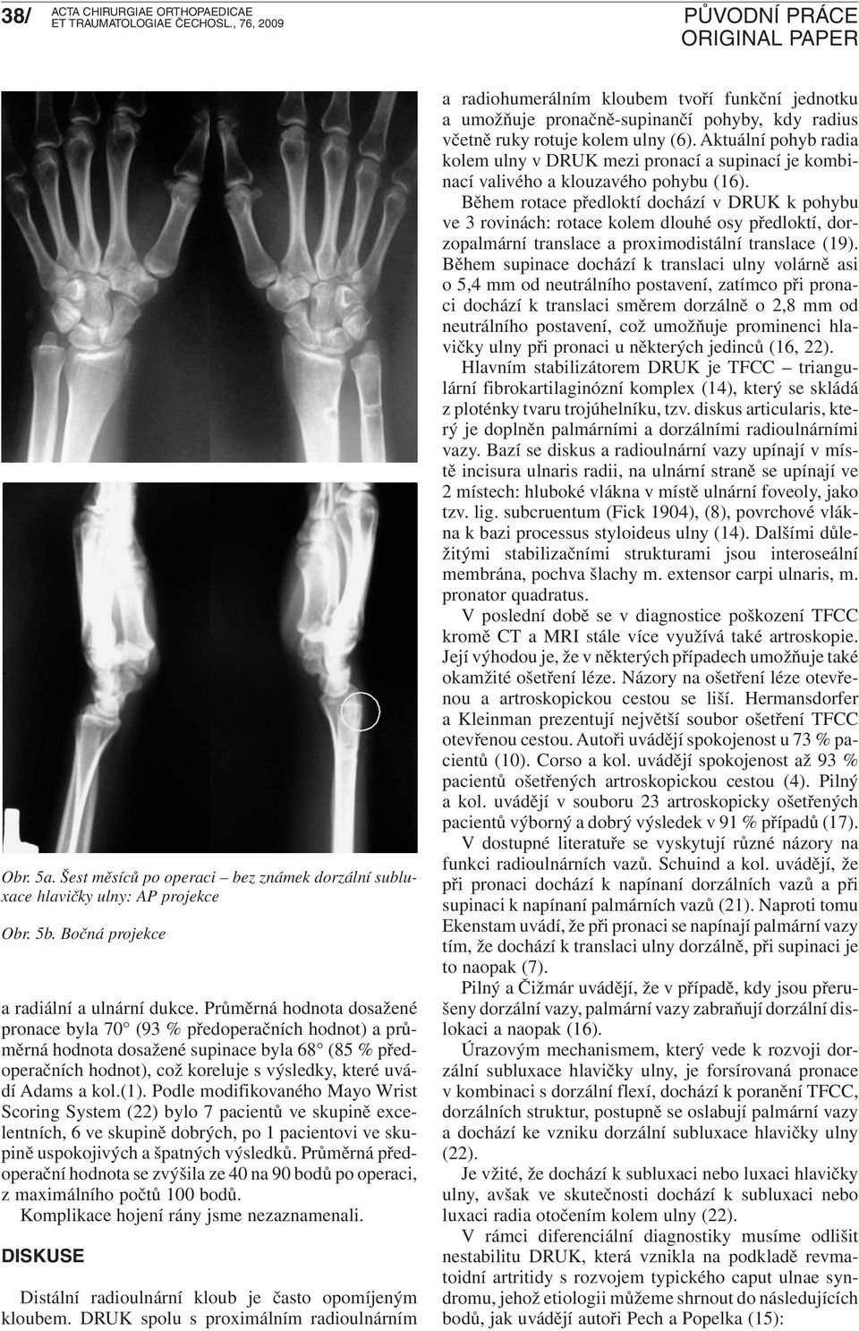 Podle modifikovaného Mayo Wrist Scoring System (22) bylo 7 pacientů ve skupině excelentních, 6 ve skupině dobrých, po 1 pacientovi ve skupině uspokojivých a špatných výsledků.