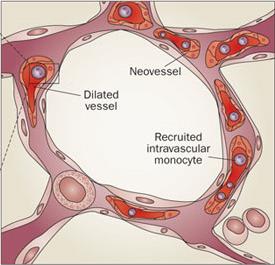 Hepatorenální a Hepatopulmonární sy Hepatorenální sy