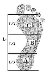 klasickým podoskopem. Otisk byl pořízen na tlakové plošině při vyšetření zvaném dynamická pedobarografie. Mezi zmíněnými parametry byla prokázána signifikantní korelace. Obr. č. 2.