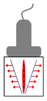 Ultrazvuková elastografie Dynamická (shear waves) elastografie Vytvoření střižných vln pomocí akustického tlaku