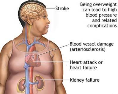 Cholesterol a metabol. syndrom Cholesterol a metabolický syndrom.