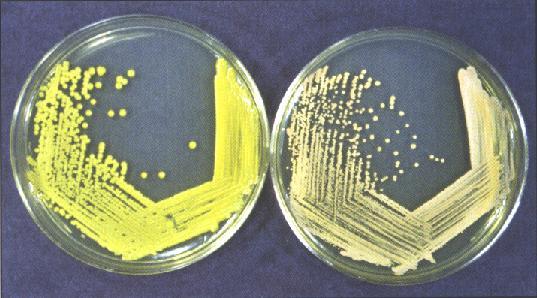Kultivace mikroorganismů Klasické mikrobiologické metody studují bakterie nikoliv jako jednotlivé buňky, ale jako populaci dceřiných buněk vzniklých dělením jedné buňky mateřské.