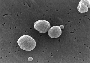 DIPLOKOKY Niesseria gonorrhoae Streptococcus pneumonie NEZNÁMÝ. Neisseria gonorrhoeae 02.png [online]. [cit. 13.4.2014]. Dostupný na WWW: http://upload.wikimedia.